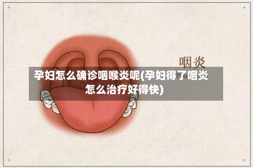 孕妇怎么确诊咽喉炎呢(孕妇得了咽炎怎么治疗好得快)-第2张图片